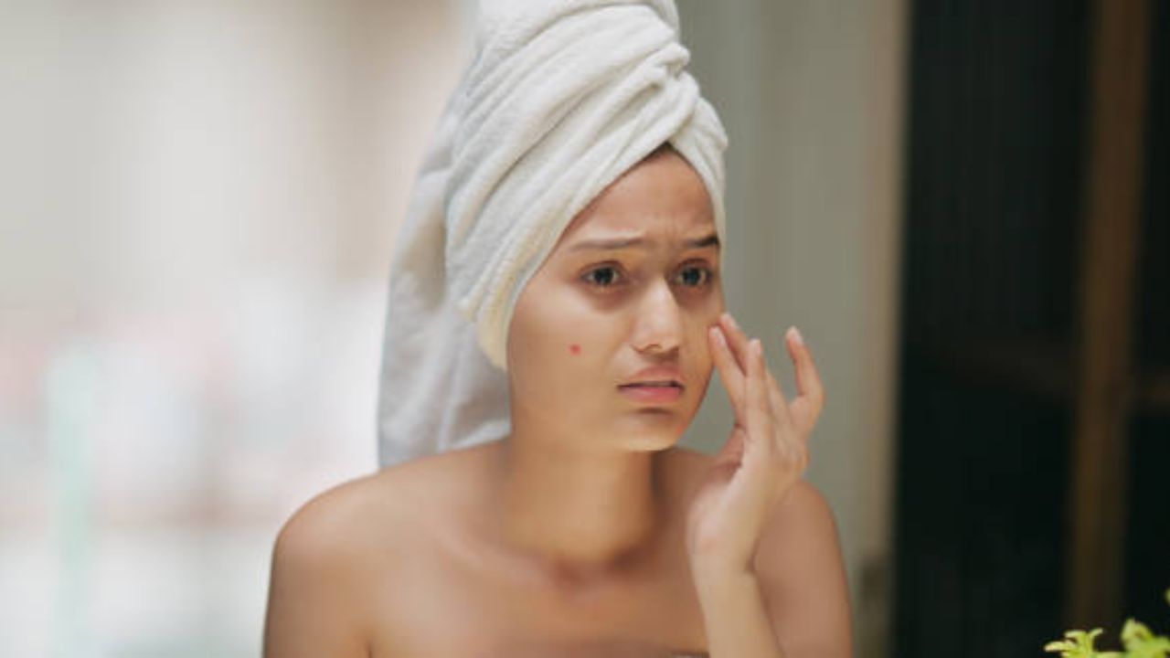 तरुण वयात चेहऱ्यावर आलेले ब्रेकआऊट्स- ऍक्ने घालवण्यासाठी करून पहा ‘हे’ सोपे घरगुती उपाय, त्वचेवर येईल ग्लो