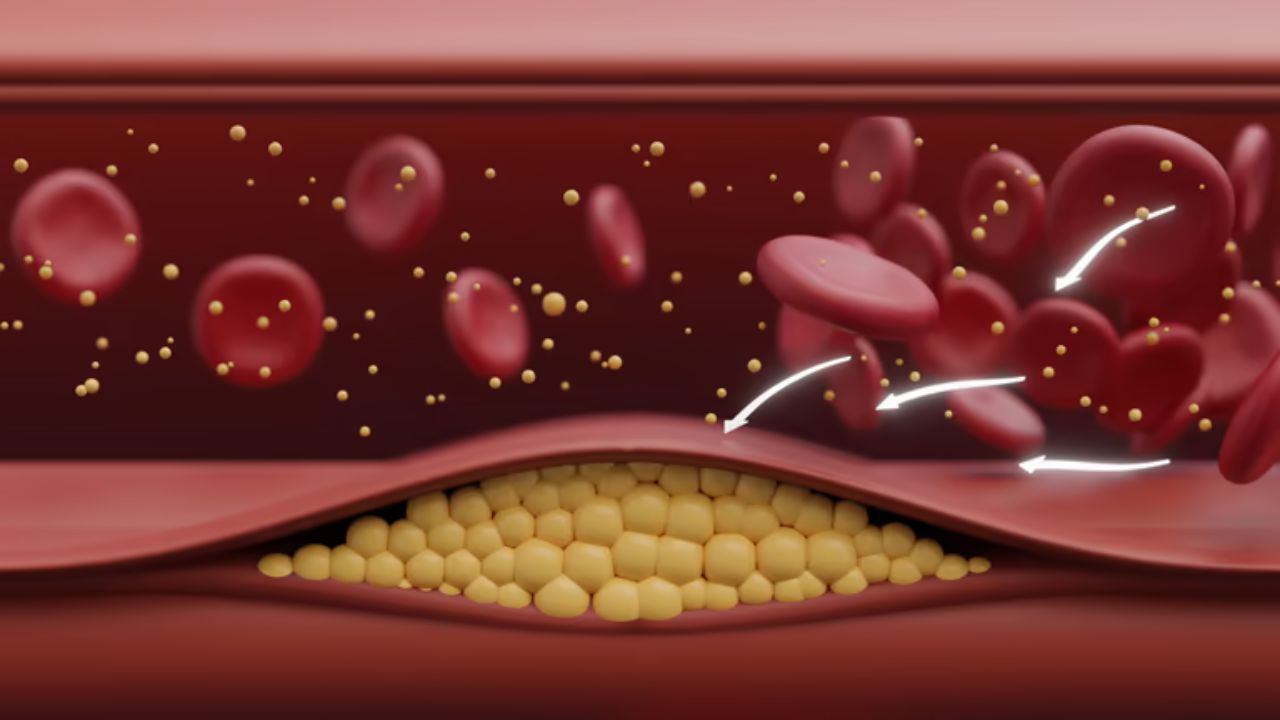रक्तवाहिन्यांना चिकलेले घाणेरडे Cholesterol नष्ट करण्यासाठी नियमित खा ‘हे’ पदार्थ, कोलेस्ट्रॉपासून मिळेल कायमची सुटका