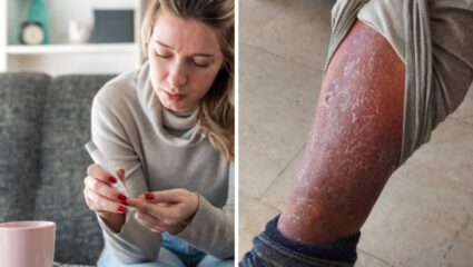 रक्तातील साखरेची पातळी नियंत्रणाबाहेर गेल्यानंतर शरीरात दिसू लागतात ‘ही’ लक्षणे, वेळीच उपचार करून वाचावा जीव