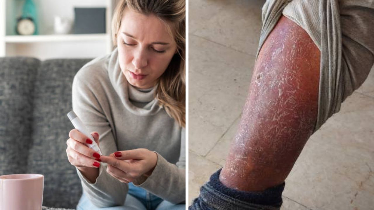 रक्तातील साखरेची पातळी नियंत्रणाबाहेर गेल्यानंतर शरीरात दिसू लागतात ‘ही’ लक्षणे, वेळीच उपचार करून वाचावा जीव