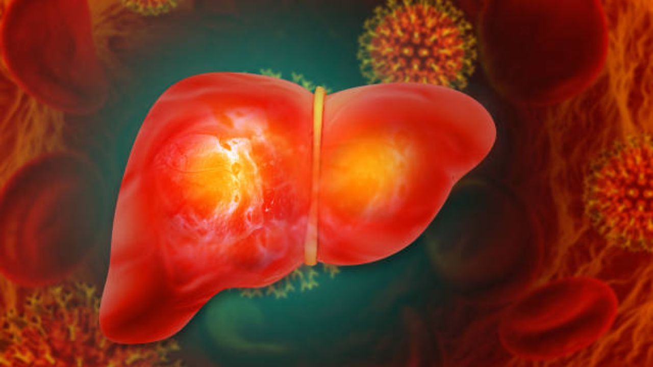 Liver Damage Symptoms: लिव्हर कुजल्यानंतर शरीरात दिसून येतात ‘ही’ गंभीर लक्षणे, शेवटचे लक्षणं वाचून सरकेल पायाखालची जमीन