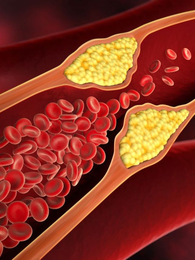 शरीरातील चांगले कोलेस्ट्रॉल वाढवण्यासाठी आहारात या गोष्टींचा समावेश करा