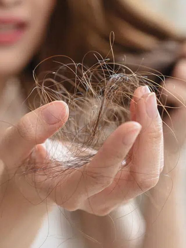 फक्त कोंड्यामुळे नाही तर 'या' विटामिन्स कमरतेमुळे होते केसगळती