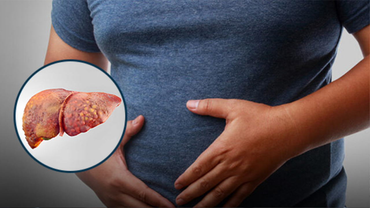 देशात फॅटी लिव्हरचे प्रमाण वाढते! रिसर्चमधून आले निदर्शनास, आतापासून टाळा या चुका