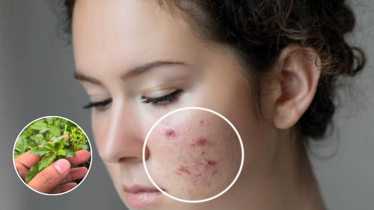 1 रुपयाही खर्च होणार नाही, चेहऱ्यावरील सर्व डाग होतील दूर… फक्त बाल्कनीतील या पानांचा वापर करा
