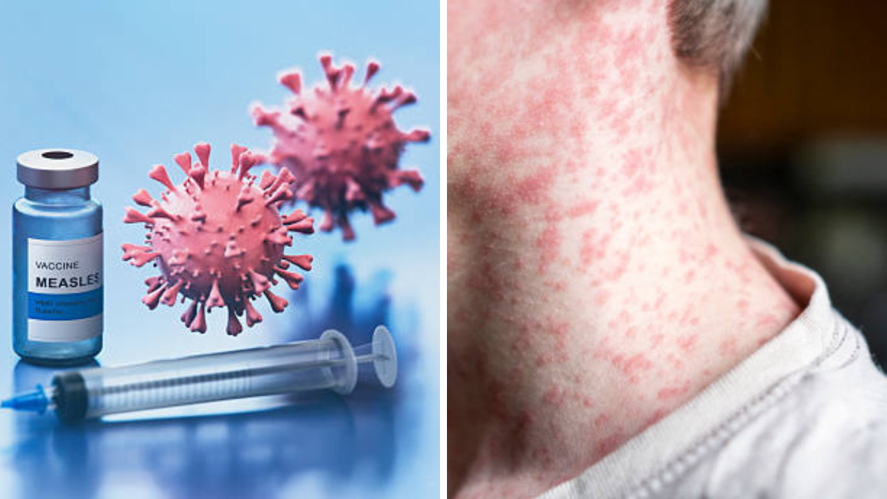 सावधान! ‘इथे’ वाढतोय धोकादायक विषाणू, शरीरातील ‘ही’ लक्षणे वेळीच ओळखा, अन्यथा गमवाल जीव