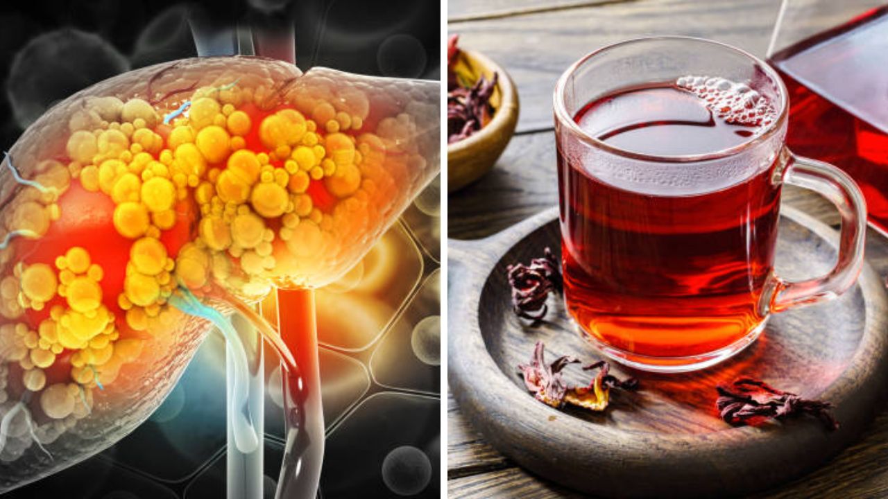 Liver वर वाढलेली अनावश्यक चरबी कायमची जाईल जळून! नियमित प्या ‘हे’ आयुर्वेदिक ड्रिंक, लिव्हरच्या आजारांपासून मिळेल सुटका