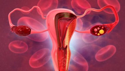 Women Health: मासिक पाळीत रक्ताच्या गाठी का पडतात? जाणून घ्या Blood Clots पडणे योग्य की अयोग्य