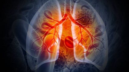 वारंवार होणारा सर्दी खोकला शरीरासाठी ठरेल घातक! Tuberculosis झाल्यानंतर दिसून येतात ‘ही’ गंभीर लक्षणे