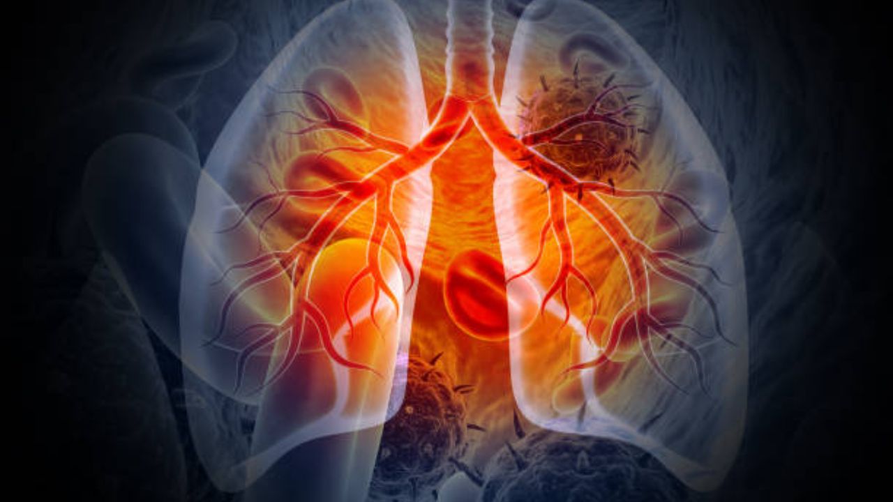 वारंवार होणारा सर्दी खोकला शरीरासाठी ठरेल घातक! Tuberculosis झाल्यानंतर दिसून येतात ‘ही’ गंभीर लक्षणे