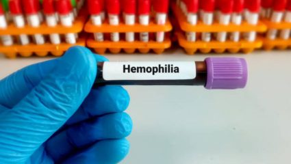 राज्यात हेमोफिलिया रुग्णांकडे दुर्लक्ष! ५,५०० रुग्णांचे आयुष्य ‘क्लॉटिंग फॅक्टर’ वर रुग्णांना हवी आहे बजेटमध्ये भरीव तरतूद