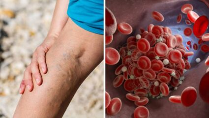 पायांवर दिसून येणाऱ्या ‘या’ रेघांकडे अजिबात करू नका दुर्लक्ष! शरीरसंबंधित उद्भवेल गंभीर आजारांचा धोका, जाणून घ्या सविस्तर