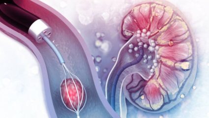 पाणी प्यायल्यानंतर लगेच लघवीला जावे लागते? जाणून घ्या वारंवार लघवीला होण्याची कारणे आणि त्यावरील उपाय