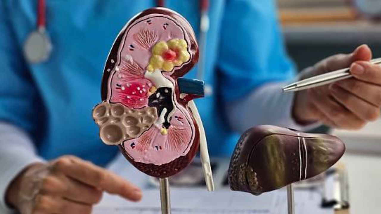 वारंवार शरीरात थकवा जाणवतोय? किडनी खराब झाल्यानंतर दिसून येतात ‘ही’ महाभयंकर लक्षणे, वेळीच घ्या डॉक्टरांचा सल्ला