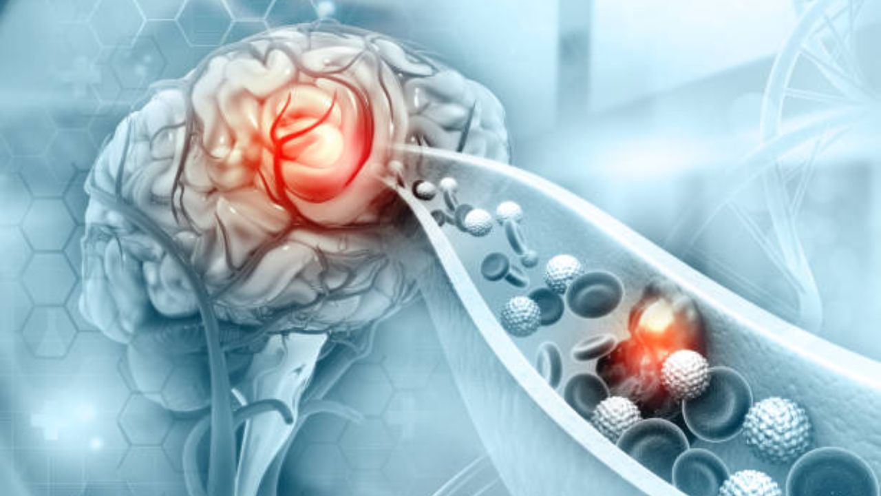 मेंदूच्या रक्तवाहिन्या का फुटतात? स्ट्रोक येण्याच्या काहीतास आधी शरीरात दिसून येतात ‘हे’ भयानक बदल, दुर्लक्ष केल्यास होईल मृत्यू