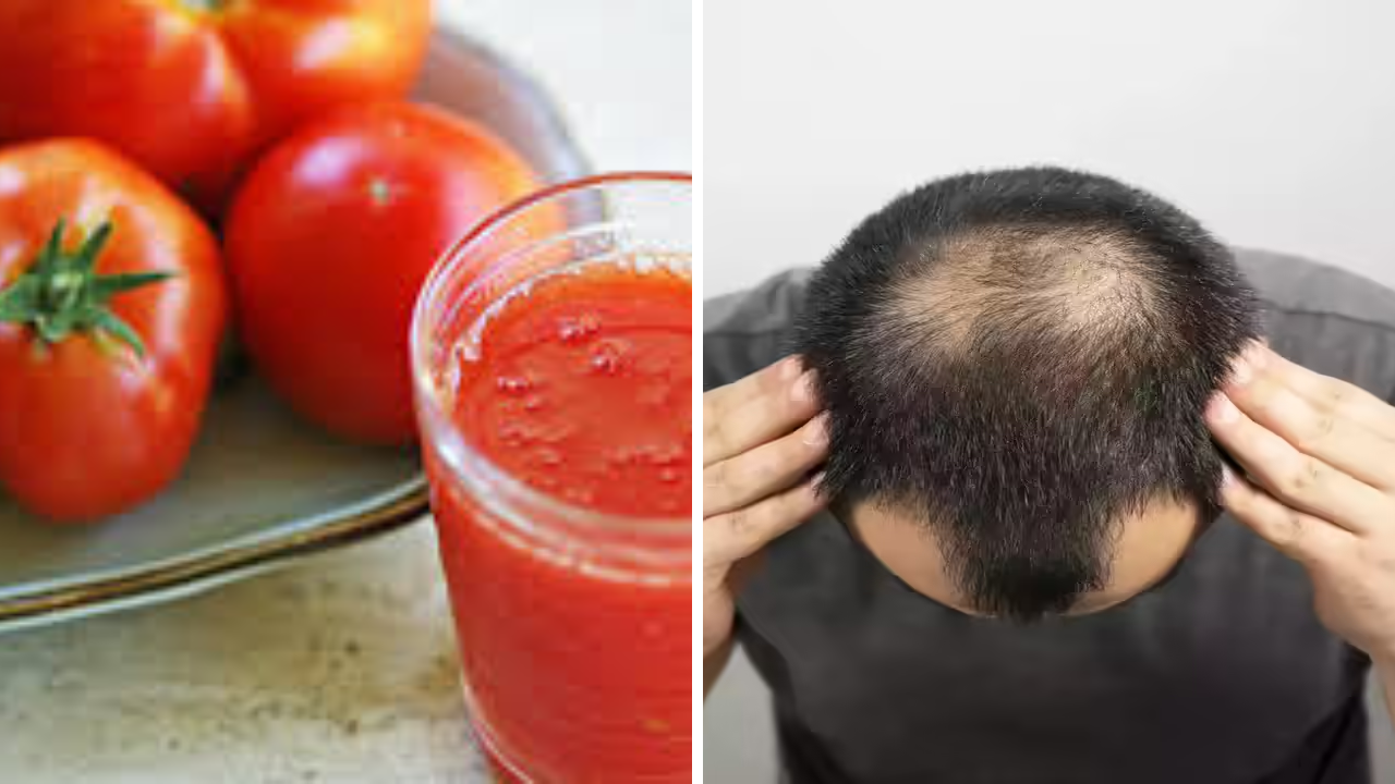 केस गळतीवर टोमॅटोचा रस रामबाण उपाय? टक्कल पडलेल्या ठिकाणीही येतील नवे केस; जाणून घ्या सत्य!