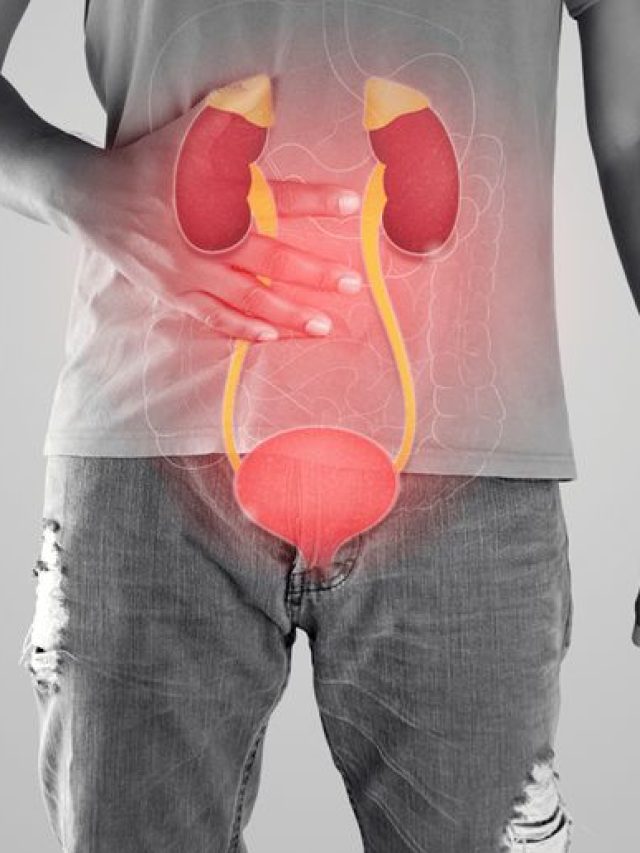 मूतखडा होऊ नये, यासाठी काय उपाय कराल?