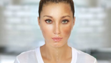 कपाळावर वाढलेला काळेपणा काही मिनिटांमध्ये होईल गायब! टॅनिंग घालवण्यासाठी करा ‘हा’ घरगुती उपाय, पार्लरचा वाचेल खर्च