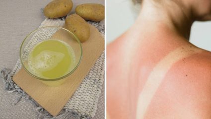 त्वचेसाठी बटाटा ठरेल वरदान! ‘या’ पद्धतीने नियमित चेहऱ्यावर लावा बटाट्याचा रस, आठवडाभरात त्वचा होईल चमकदार