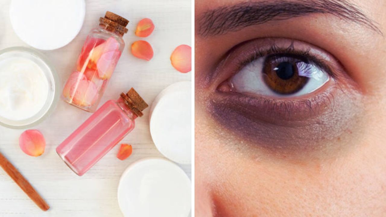 Dark Circles: डोळ्यांभोवती वाढलेल्या डार्क सर्कल्समुळे त्वचा खूप जास्त निस्तेज दिसते? मग ‘हे’ घरगुती उपाय करून मिळवा आराम