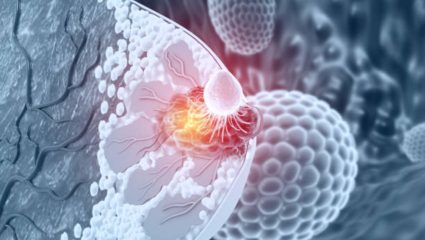 तरुण वयात Breast Cancer होण्यास कारणीभूत ठरतात ‘ही’ गंभीर कारणे, स्तनात गाठी होऊ नये आहारात करा बदल