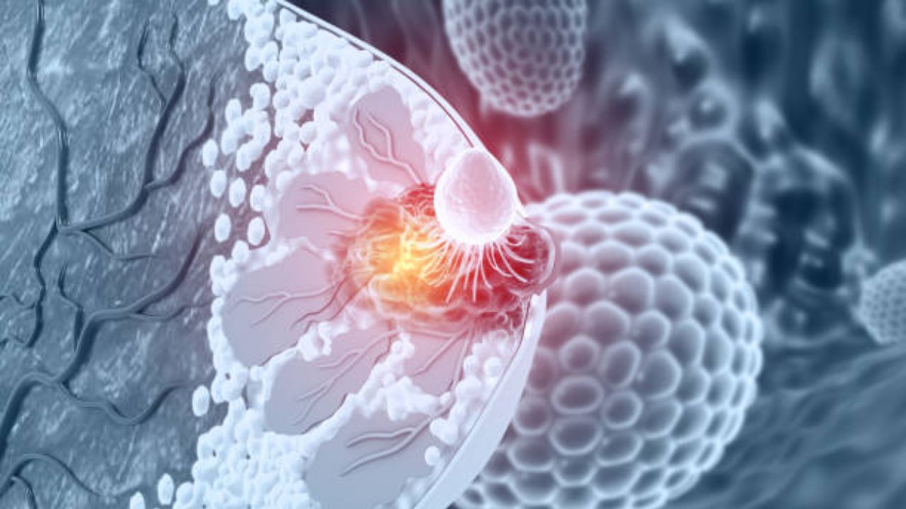 तरुण वयात Breast Cancer होण्यास कारणीभूत ठरतात ‘ही’ गंभीर कारणे, स्तनात गाठी होऊ नये आहारात करा बदल