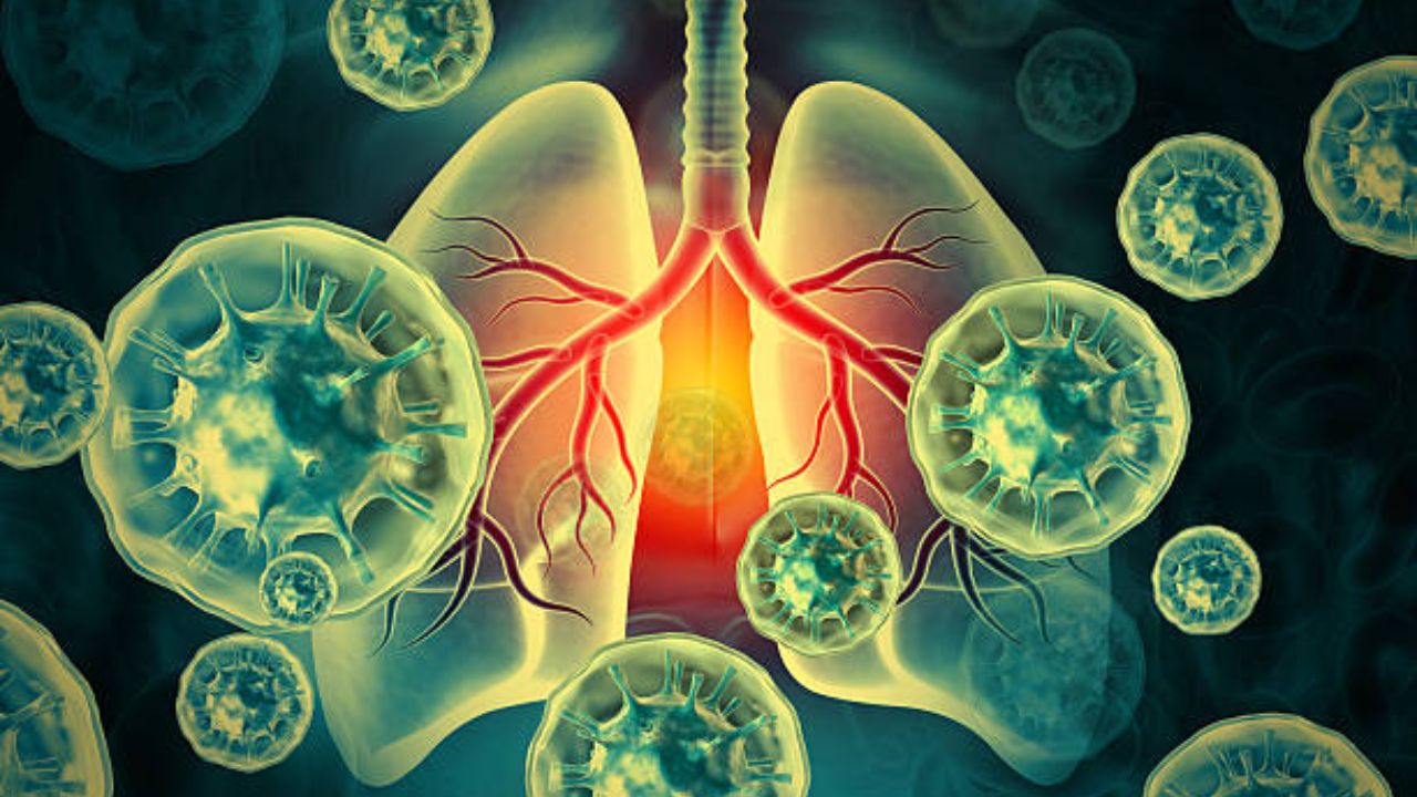 क्षयरोग निदानाचा वेग वाढला! २०२१ पासून शोधमोहीम, रुग्णसंख्येत वाढ मात्र पॉझिटिव्हिटी दरात घट