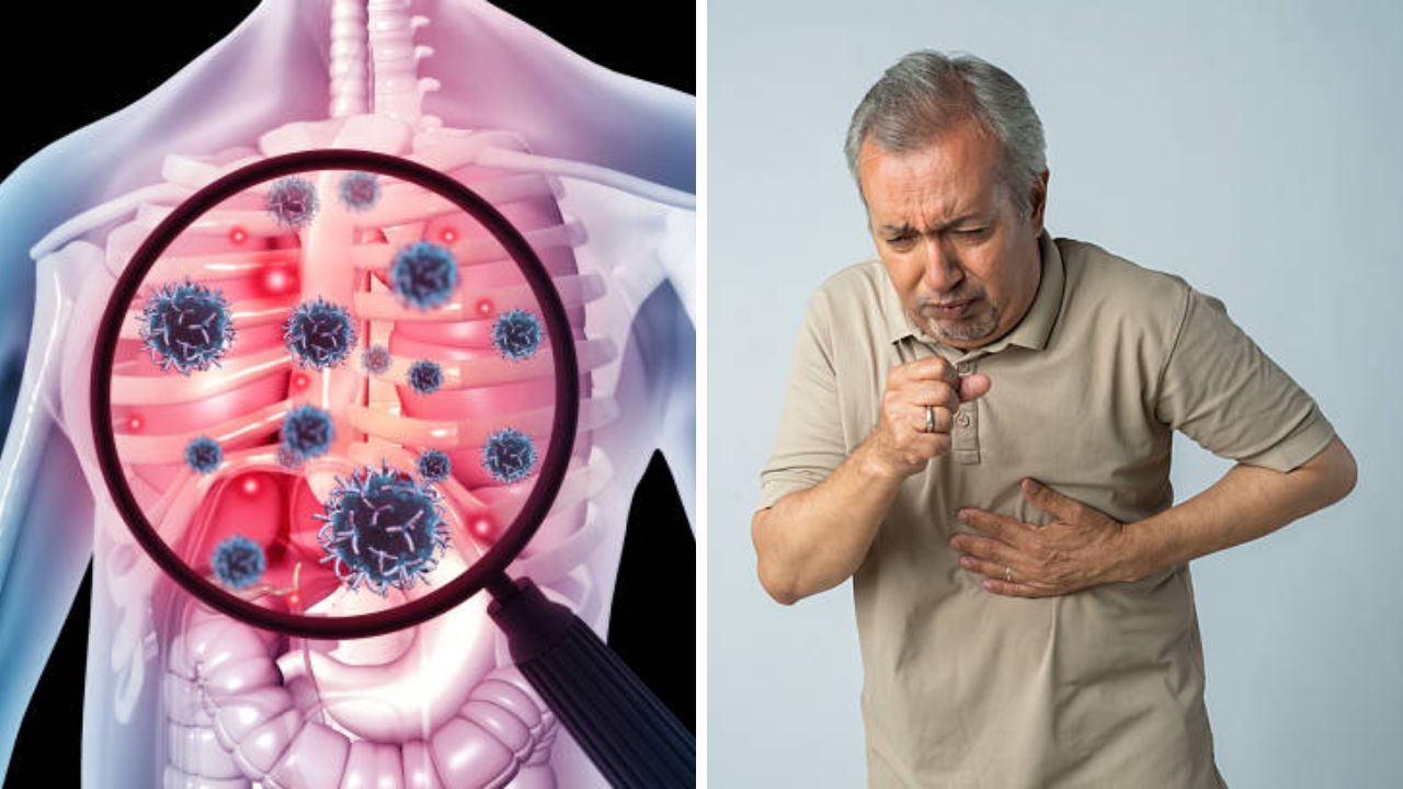 भारतात क्षयरोगाचे वाढते संकट! प्रतिबंधासाठी साधे उपाय करून मिळवता येईल नियंत्रण, जाणून घ्या तज्ज्ञांनी दिलेली सविस्तर माहिती