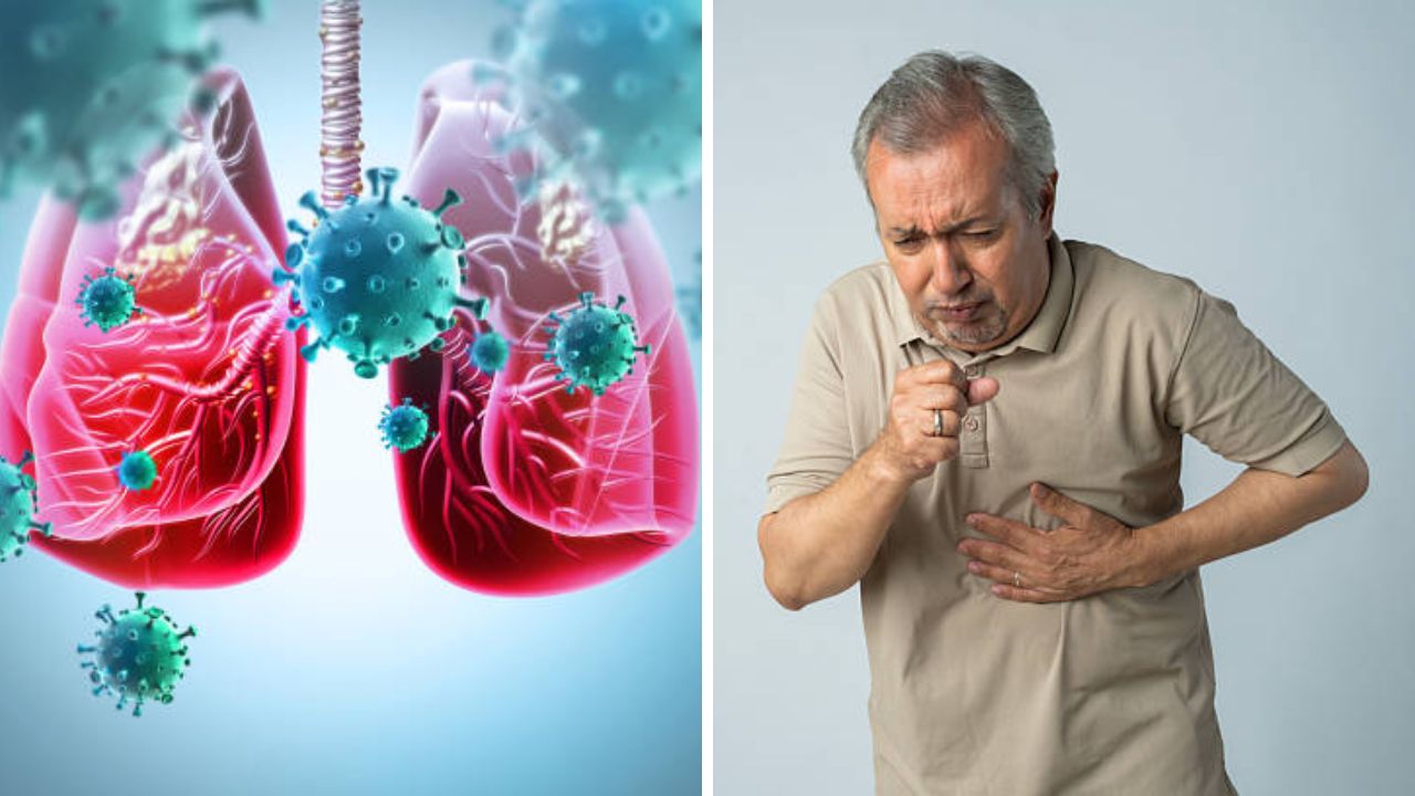 भारतात क्षयरोगाचे वाढते संकट! प्रतिबंधासाठी साधे उपाय करून मिळवता येईल नियंत्रण, जाणून घ्या तज्ज्ञांनी दिलेली सविस्तर माहिती