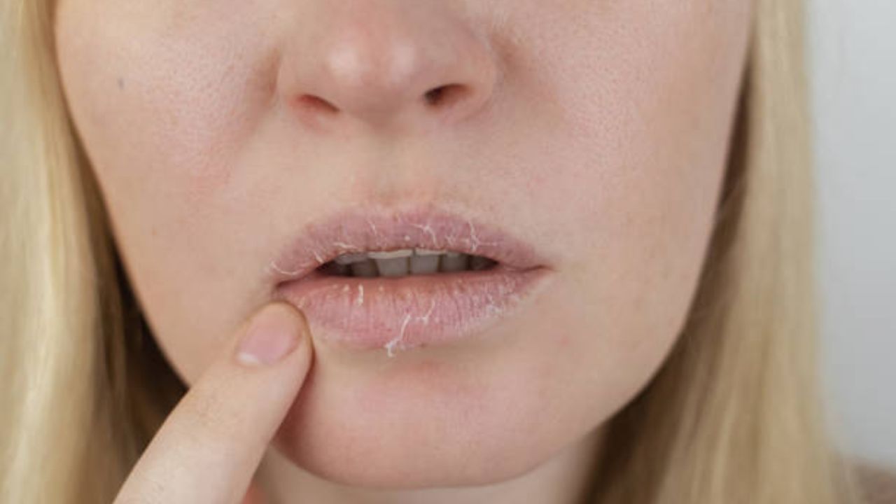 ओठांवर जमा झालेली डेड स्किन काढून टाकण्यासाठी साखर मधाचा ‘या’ पद्धतीने करा वापर, ओठ होतील चमकदार