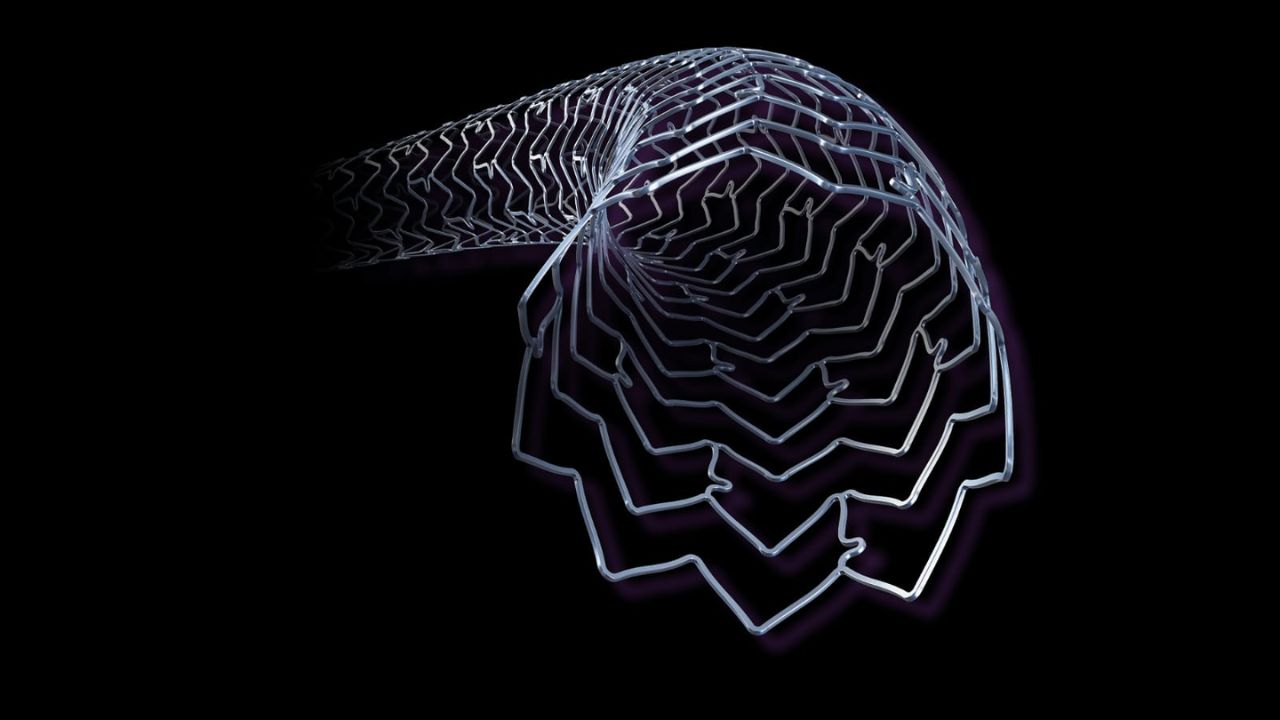 Abbott India Health: हृदयविकाराच्या उपचारात नवी क्रांती! अ‍ॅबॉटने भारतात लाँच केला प्रगत स्टेंट ‘झायन्स स्कायपॉइंट’