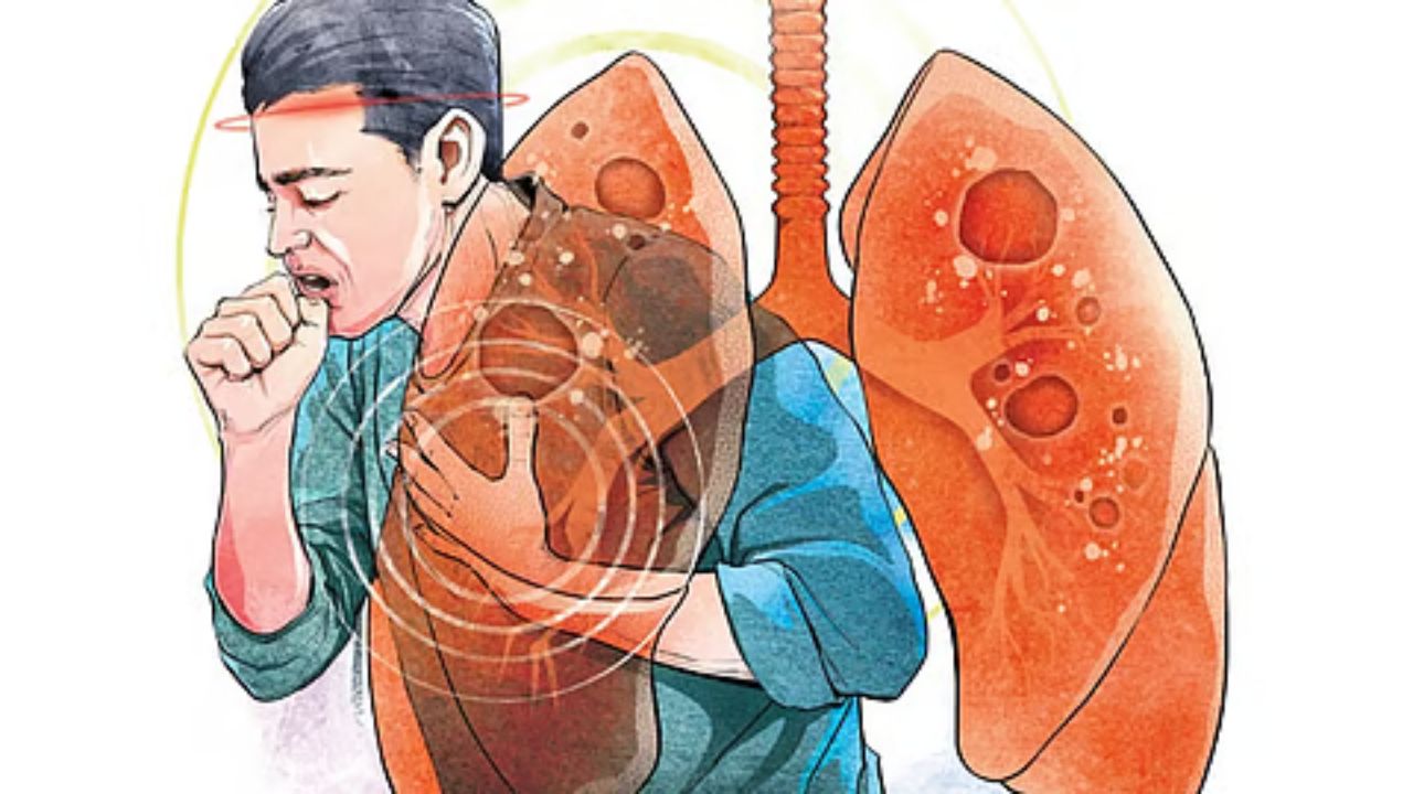 Gadchiroli News: गडचिरोलीत वर्षभरात २०७५ क्षयरुग्णांची नोंद! आरोग्य विभागाचा धोक्याचा इशारा