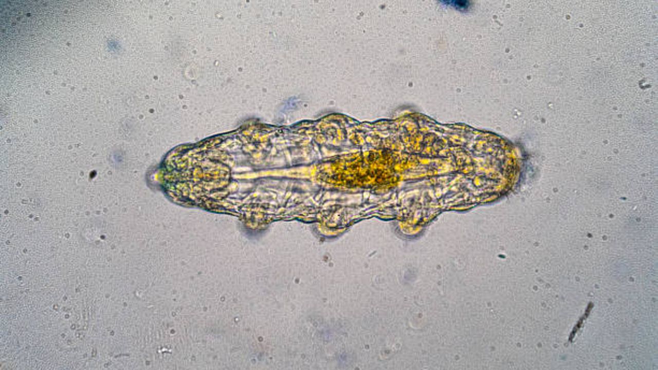 गॅस्ट्रोट्रिच हा पाण्यात राहणारा जीव आहे. आकाराने अतिशय लहान असलेला जीव डोळ्यांनासुद्धा व्यवस्थित दिसून येत नाही. या जीवाचे आयुष्य ३ किंवा ४ दिवसांमध्येच संपून जाते. 