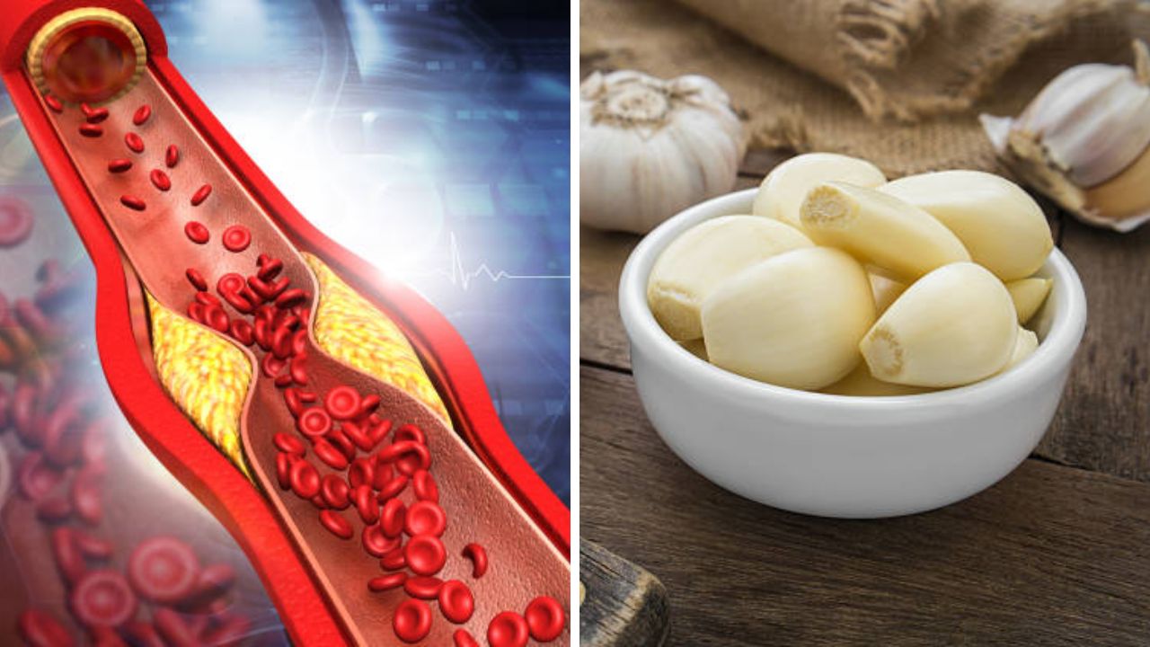 लसूण खाल्ल्यामुळे कोलेस्ट्रॉल खरंच नष्ट होते का? हृदयाचे आरोग्य निरोगी ठेवण्यासाठी लसूण कधी आणि किती वेळा खावी