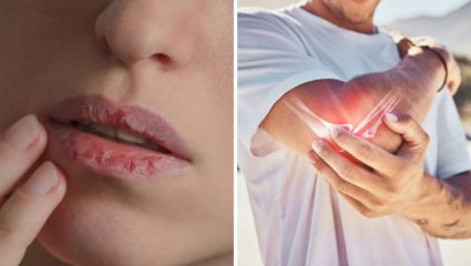 Health Care Tips: शरीरात वात वाढल्यानंतर दिसून येतात ‘ही’ गंभीर लक्षणे, दुर्लक्ष करणे आरोग्यासाठी ठरेल धोक्याचे