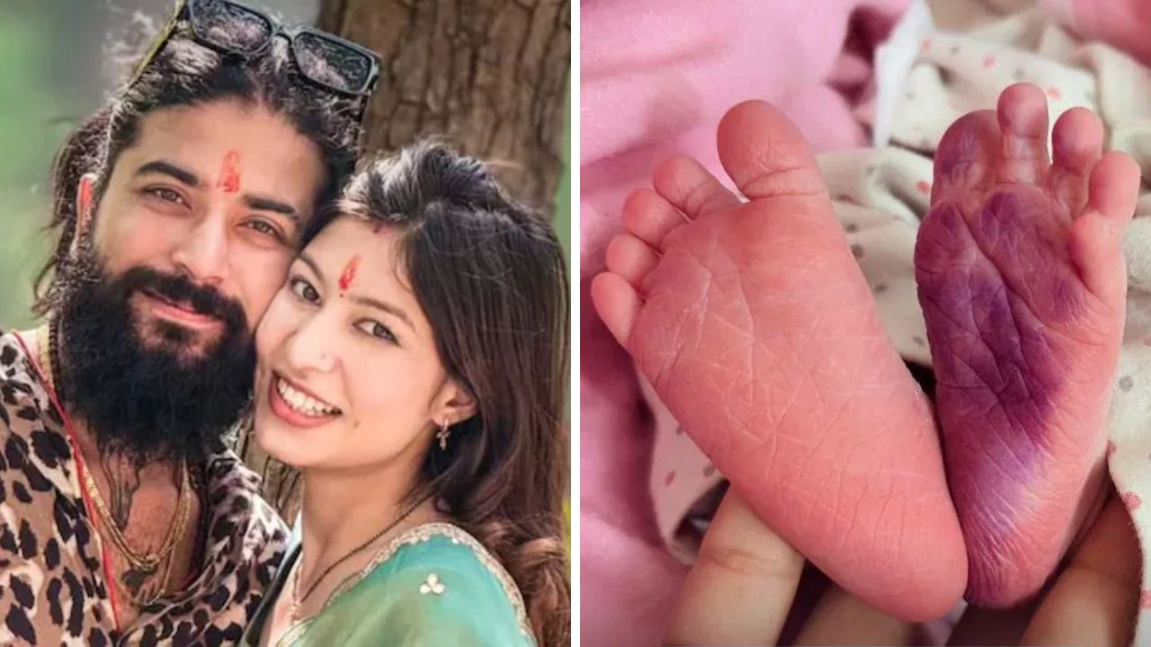 Anurag Dobhal च्या उपचारादरम्यान पत्नी Ritika ने दिली खास आनंदाची बातमी, शेअर केली बाळाची पहिली झलक