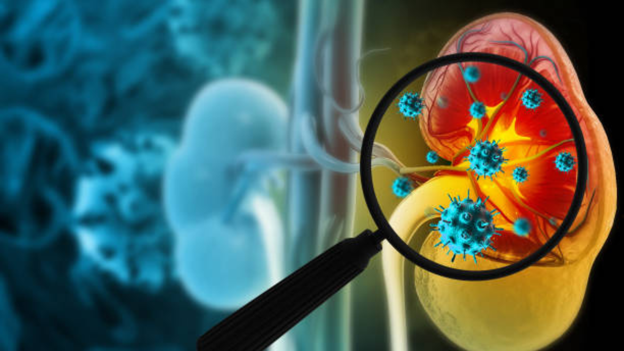 आतड्यात आराम करणारा 1 बॅक्टेरियामुळेच होते Kidney Infection, कसे ठेवाल स्वतःला संक्रमणापासून दूर
