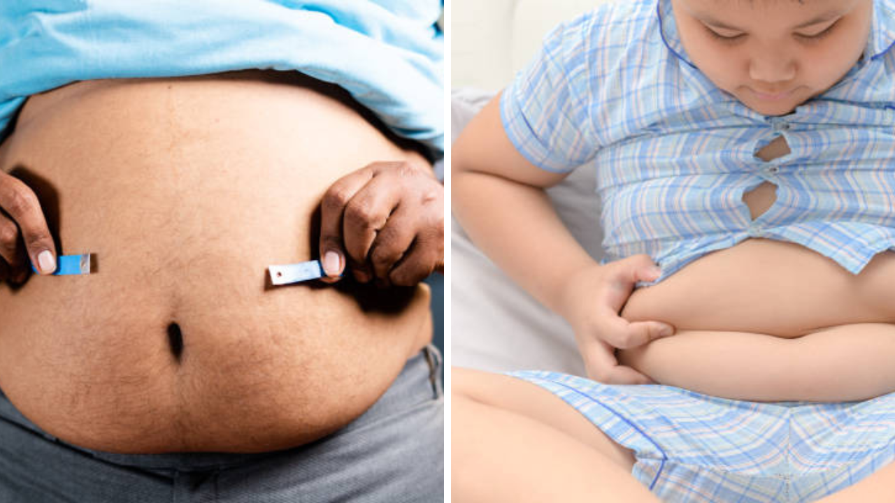 World Obesity Day 2026: शेकडो आजारांचे मूळ आहे लठ्ठपणा, शरीर सडवण्यापासून अटॅक येण्यापर्यंत त्रास; वेळीच करा वजन कमी