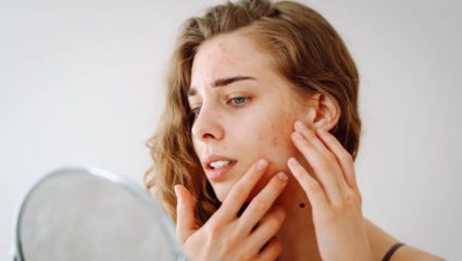 वारंवार पिंपल्स येणे फक्त घाणीचे लक्षण नसून असू शकते ‘या’ आजारांचे संकेत, वेळीच ओळखा आणि जीव वाचवा
