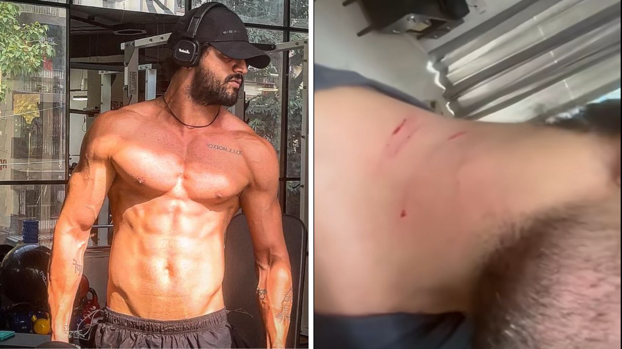 Ex गर्लफ्रेंडने घरात घुसून अभिनेत्यावर केला हल्ला? मान-पाठीवर नखाचे ठसे, व्हिडिओ पाहून व्हाल थक्क