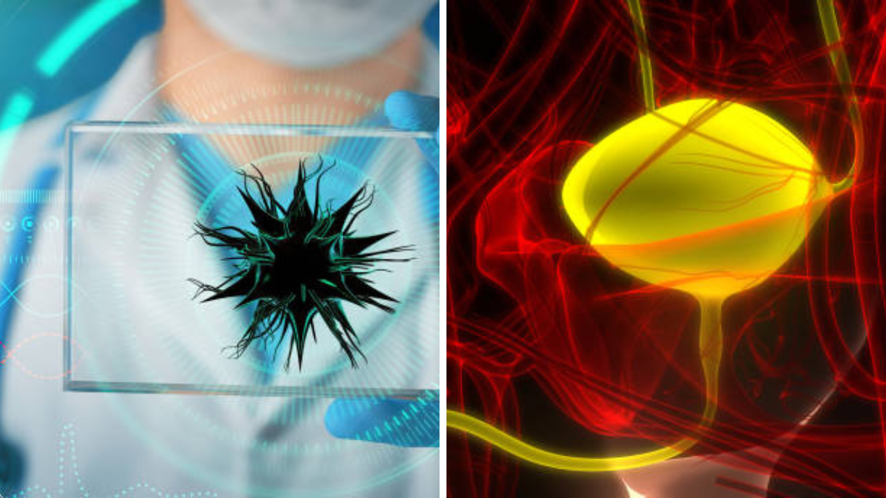 टणक साबणाने Private Part घासताय? व्हा वेळीच सावध! होऊ शकतो Urethritis, महिला-पुरुषांनी काय घ्यावी काळजी