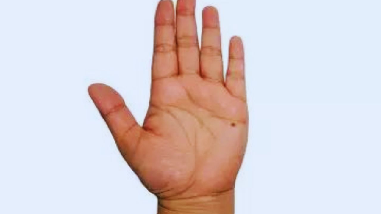 Samurdrik Shastra: तुमच्या तळहातावरही तीळ आहे का? तुम्हाला कधीही भासणार नाही संपत्तीची कमतरता