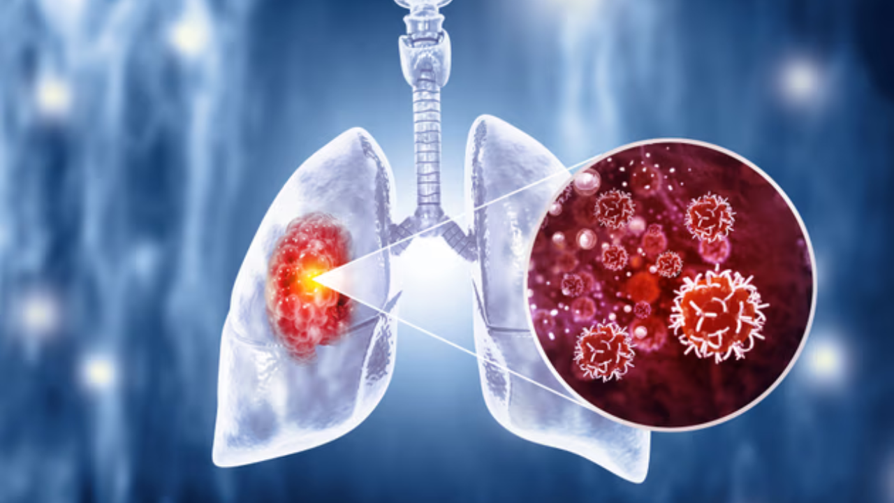 धूम्रपान न करणाऱ्यांनाही फुफ्फुसाच्या Cancer चा धोका? कीटकनाशकांचा दीर्घकालीन संपर्क ठरू शकतो घातक; संशोधनात नेमकं काय?