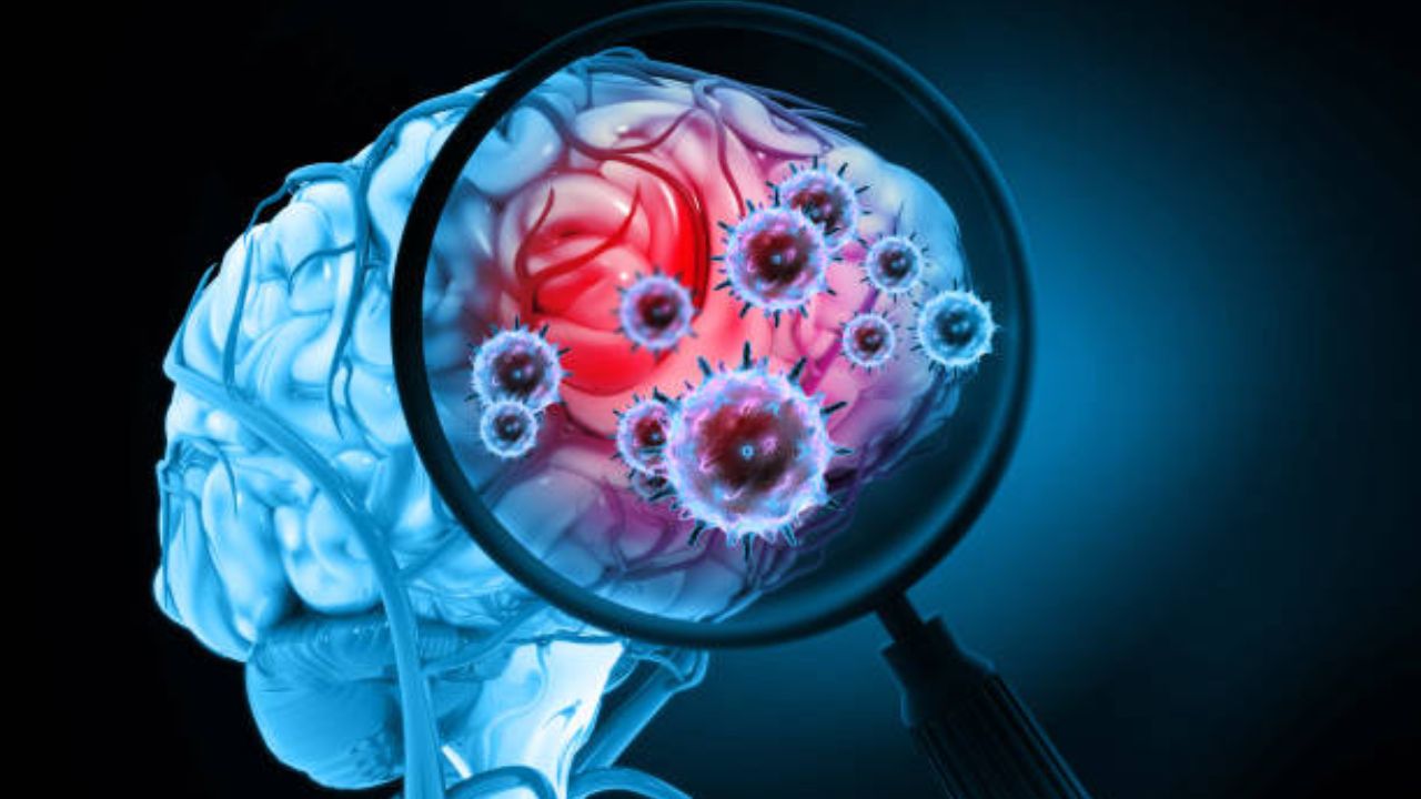 ‘शताब्दी’त दुर्मीळ मेंदूतील गाठीवर उपचार! ९ वर्षीय मुलीला नवजीवन; संसर्गातून उद्भवलेल्या आजारावर मात