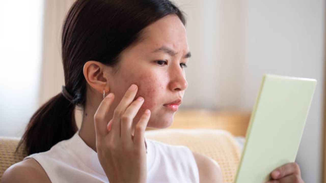 उन्हाळामुळे काळवंडलेली त्वचा पुन्हा एकदा होईल चमकदार! त्वचेवर लावा Coconut Face Pack, टॅनिंग होईल गायब