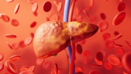 Fatty Liver म्हणजे काय? लिव्हरमध्ये जमा झालेली अनावश्यक चरबी नष्ट करण्यासाठी आहारात करा ‘या’ पदार्थांचा समावेश