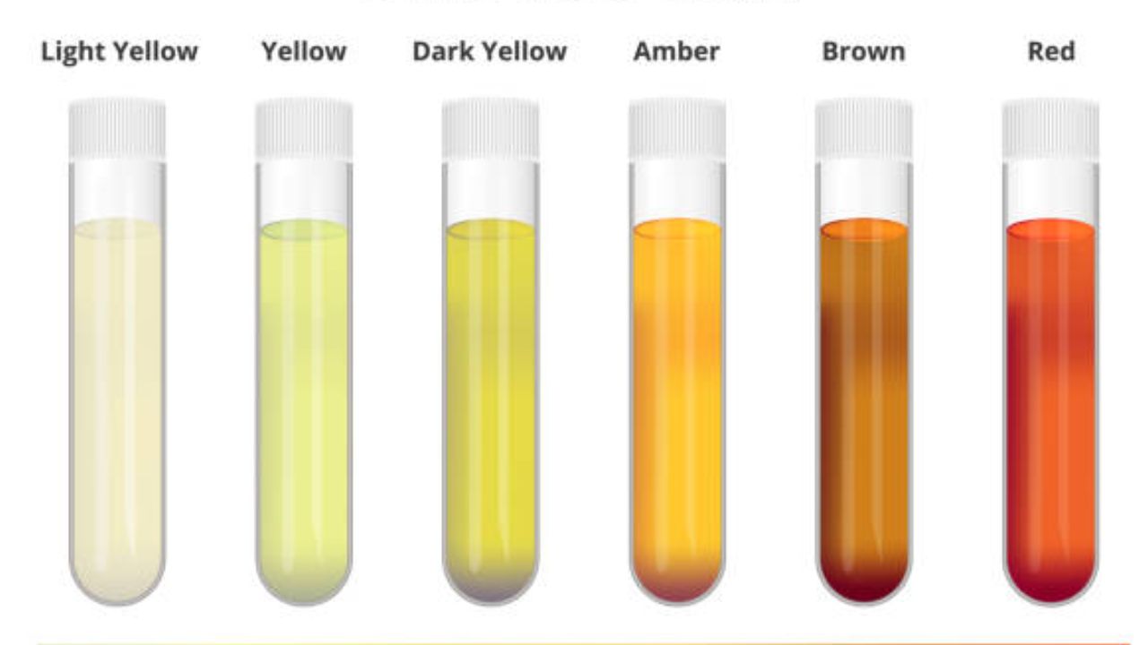 लघवी करताना कायमच जळजळ होते? लघवीच्या रंगावरून ओळखा गंभीर आजारांचे संकेत, दुर्लक्ष करणे शरीरासाठी ठरेल धोक्याचे