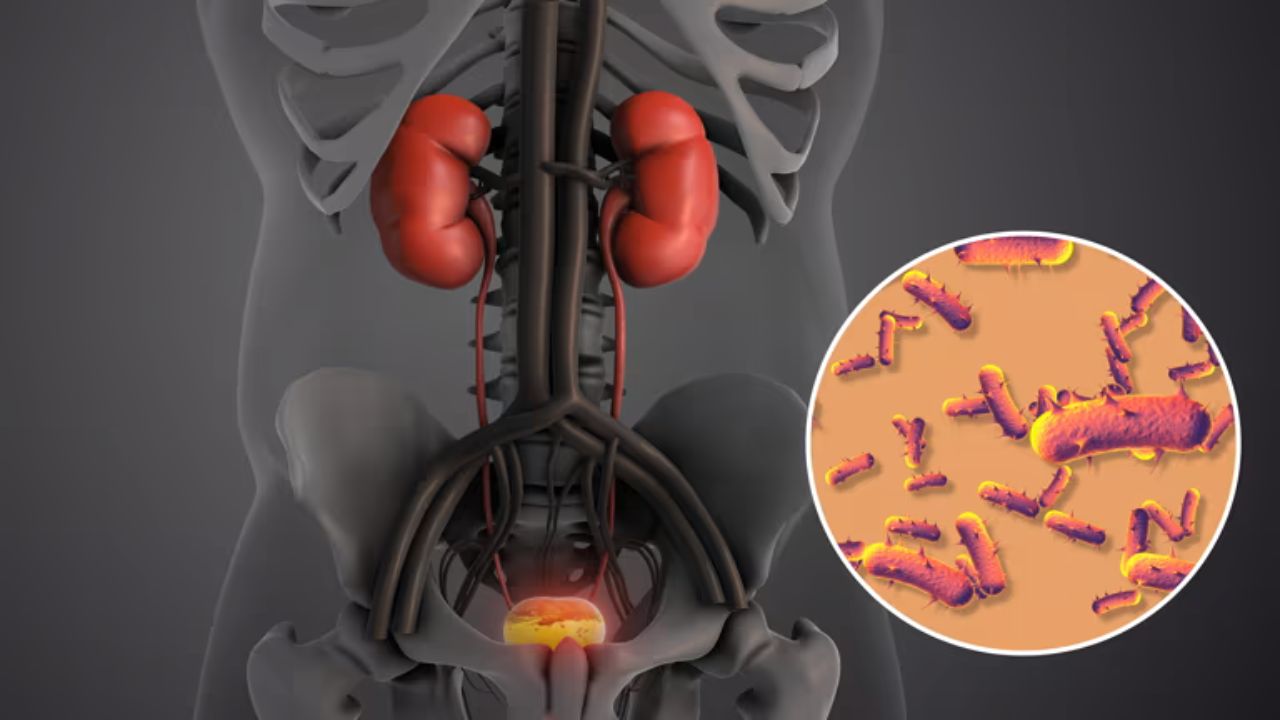 UTI झाल्यानंतर योग्य वेळी उपचार न केल्यास भासू शकते डायलीसिसची गरज, शरीरात दिसणाऱ्या ‘या’ लक्षणांकडे अजिबात करू नका दुर्लक्ष