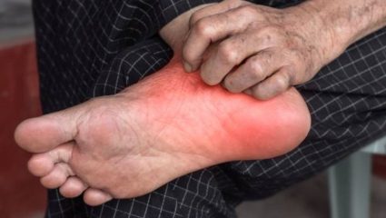 तळपायांमध्ये कायमच जळजळ आणि आग होते? शरीरात वाढलेली उष्णता कमी करण्यासाठी करा ‘हे’ घरगुती उपाय
