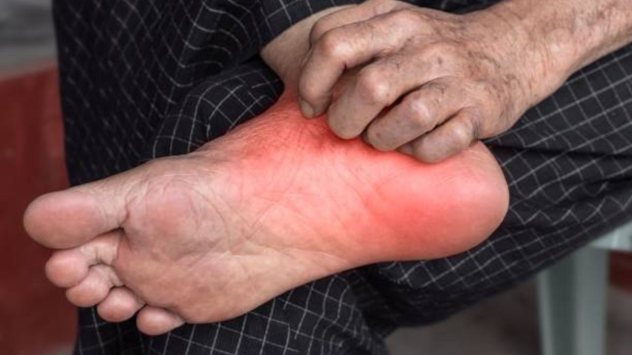 तळपायांमध्ये कायमच जळजळ आणि आग होते? शरीरात वाढलेली उष्णता कमी करण्यासाठी करा ‘हे’ घरगुती उपाय